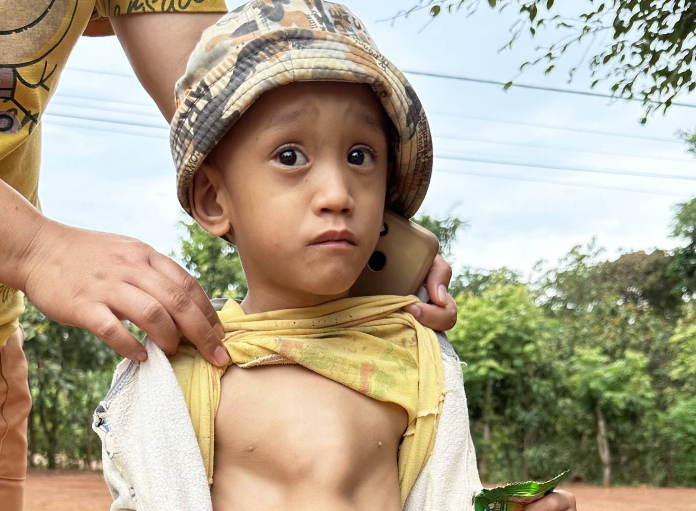 Y Chươn Kễn